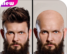 Bald